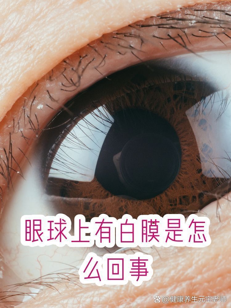 眼睛白膜可以徹底治愈嗎