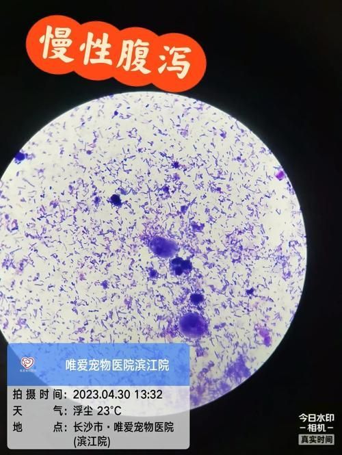 菌鰒和蟲鰓的治療方法有哪些，權威醫學治療“蟲鰓”和“腸道寄生蟲感染”治療方法