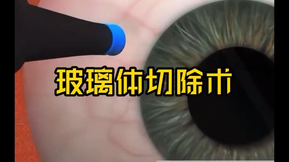 重度蒙眼病如何治療，重度蒙眼病治療方法
