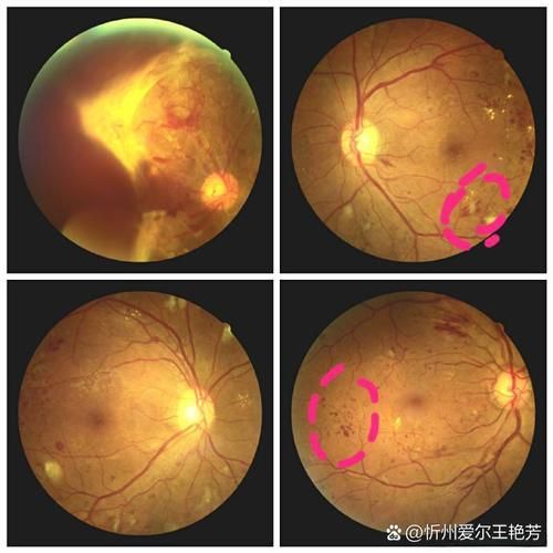 如何判斷紅龍魚(yú)是否突眼 如何判斷紅龍魚(yú)是否突眼 龍魚(yú)百科 第6張