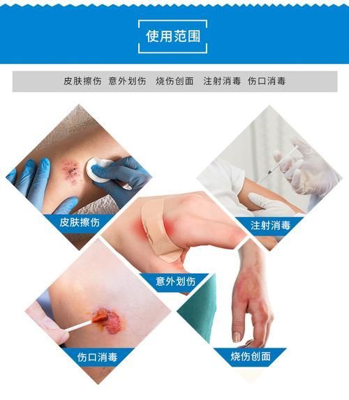 如何判斷碘伏是否完全清除，如何判斷碘伏完全清除