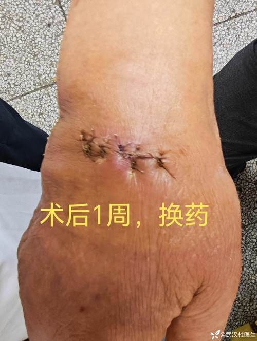 龍魚攻擊黑尾大勾后如何處理？，用戶要求詳解龍魚攻擊黑尾大勾后如何處理，需提供1000字左右的詳細(xì)說明并配圖