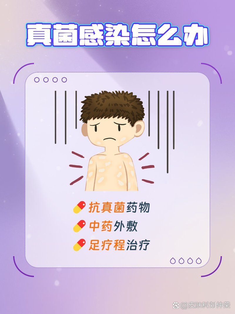 真菌和細菌感染的治療方法有哪些，真菌與細菌感染的區別