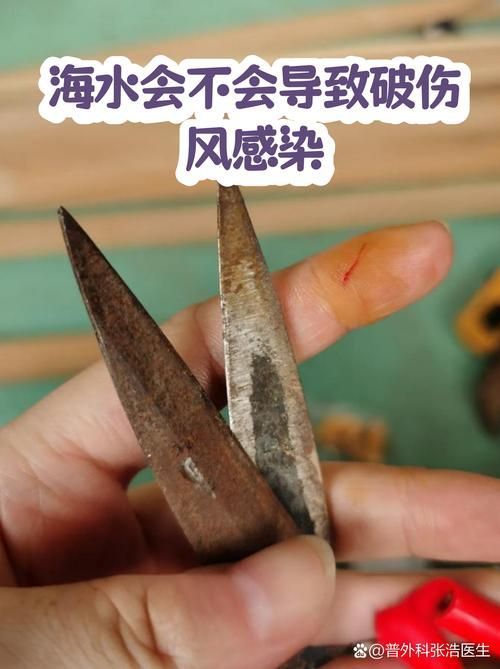 海水細菌感染如何預防，海水細菌感染的預防 海水細菌感染如何預防，海水細菌感染的預防 龍魚百科 第3張