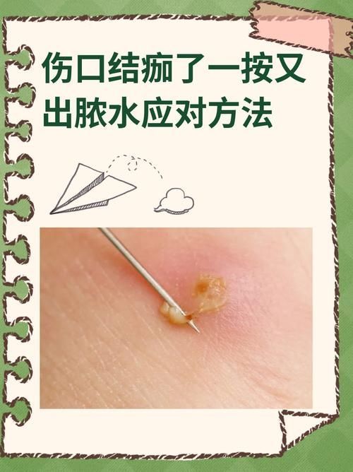 海水細菌感染如何預防，海水細菌感染的預防 海水細菌感染如何預防，海水細菌感染的預防 龍魚百科 第6張