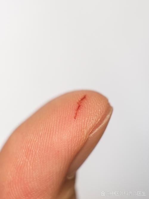 海水細菌感染如何預防，海水細菌感染的預防 海水細菌感染如何預防，海水細菌感染的預防 龍魚百科 第5張