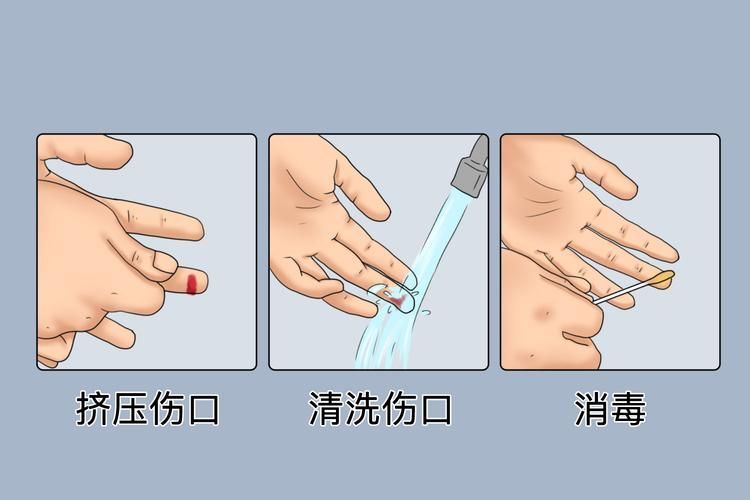 海水細菌感染如何預防，海水細菌感染的預防 海水細菌感染如何預防，海水細菌感染的預防 龍魚百科 第1張