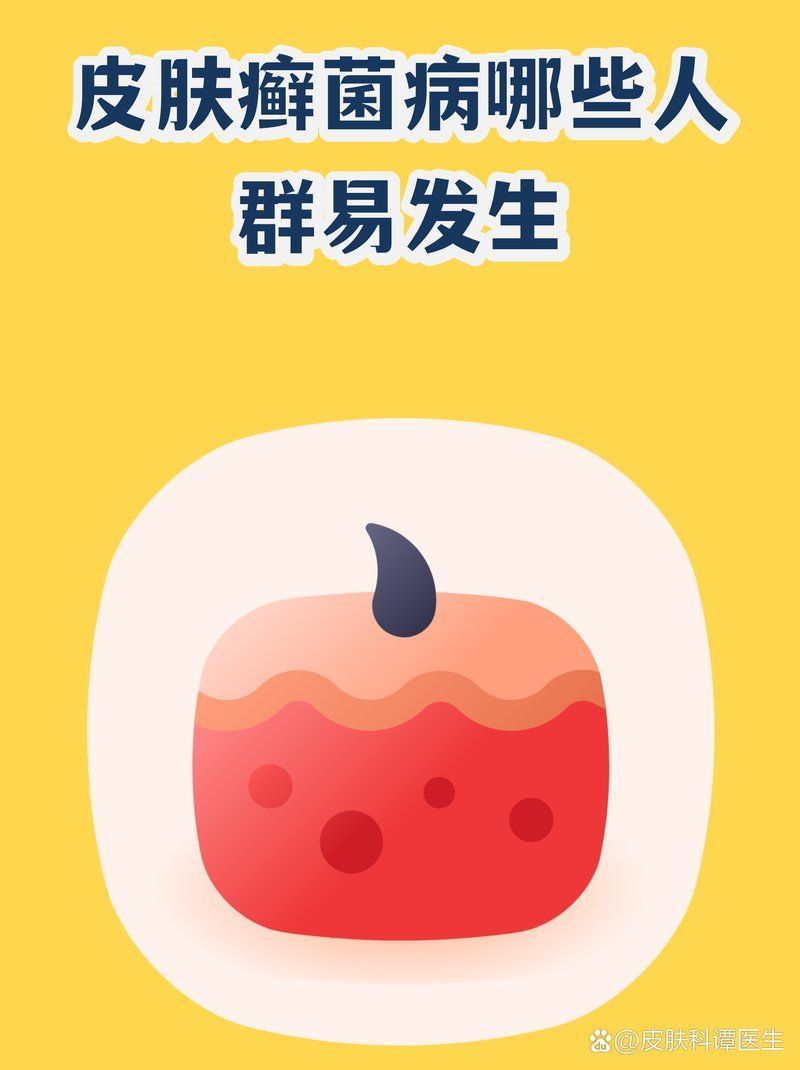 哪些人群容易發生真菌感染，哪些人容易被真菌“盯上”？ 哪些人群容易發生真菌感染，哪些人容易被真菌“盯上”？ 龍魚百科 第2張