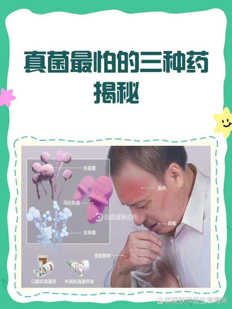 有哪些藥物可以治療真菌感染，真菌感染用什么藥最好 有哪些藥物可以治療真菌感染，真菌感染用什么藥最好 龍魚百科 第1張