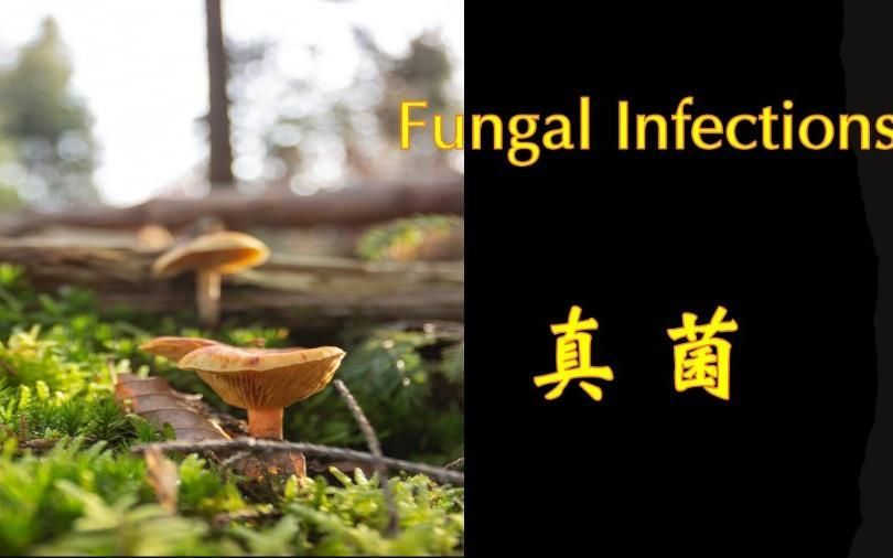 有哪些藥物可以治療真菌感染，真菌感染用什么藥最好 有哪些藥物可以治療真菌感染，真菌感染用什么藥最好 龍魚百科 第3張