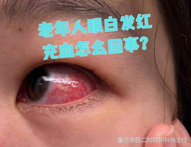 再次充血后如何治療更有效，權(quán)威醫(yī)學(xué)指南、三甲醫(yī)學(xué)指南、三甲醫(yī)院診療方案調(diào)用工具