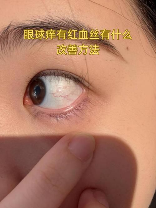 再次充血后如何治療更有效，權(quán)威醫(yī)學(xué)指南、三甲醫(yī)學(xué)指南、三甲醫(yī)院診療方案調(diào)用工具