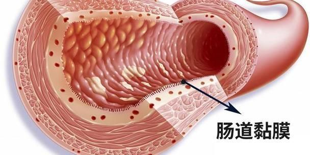 魚腸炎好轉后需要多久恢復健康,魚腸炎好轉后需要多久恢復健康因個體而異 龍魚百科 第3張 魚腸炎好轉后需要多久恢復健康,魚腸炎好轉后需要多久恢復健康因個體而異 魚腸炎好轉后需要多久恢復健康,魚腸炎好轉后需要多久恢復健康因個體而異 龍魚百科 第3張