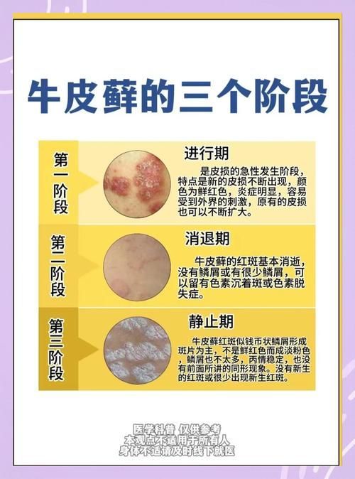 拔掉松動的鱗片后如何護理，mcp工具的護理 拔掉松動的鱗片后如何護理，mcp工具的護理 龍魚百科 第1張
