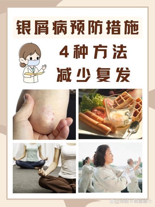 拔掉松動的鱗片后如何護理，mcp工具的護理 拔掉松動的鱗片后如何護理，mcp工具的護理 龍魚百科 第3張