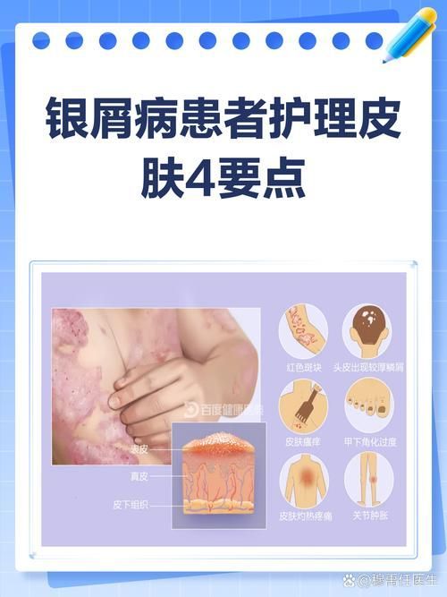 拔掉松動的鱗片后如何護理，mcp工具的護理 拔掉松動的鱗片后如何護理，mcp工具的護理 龍魚百科 第4張