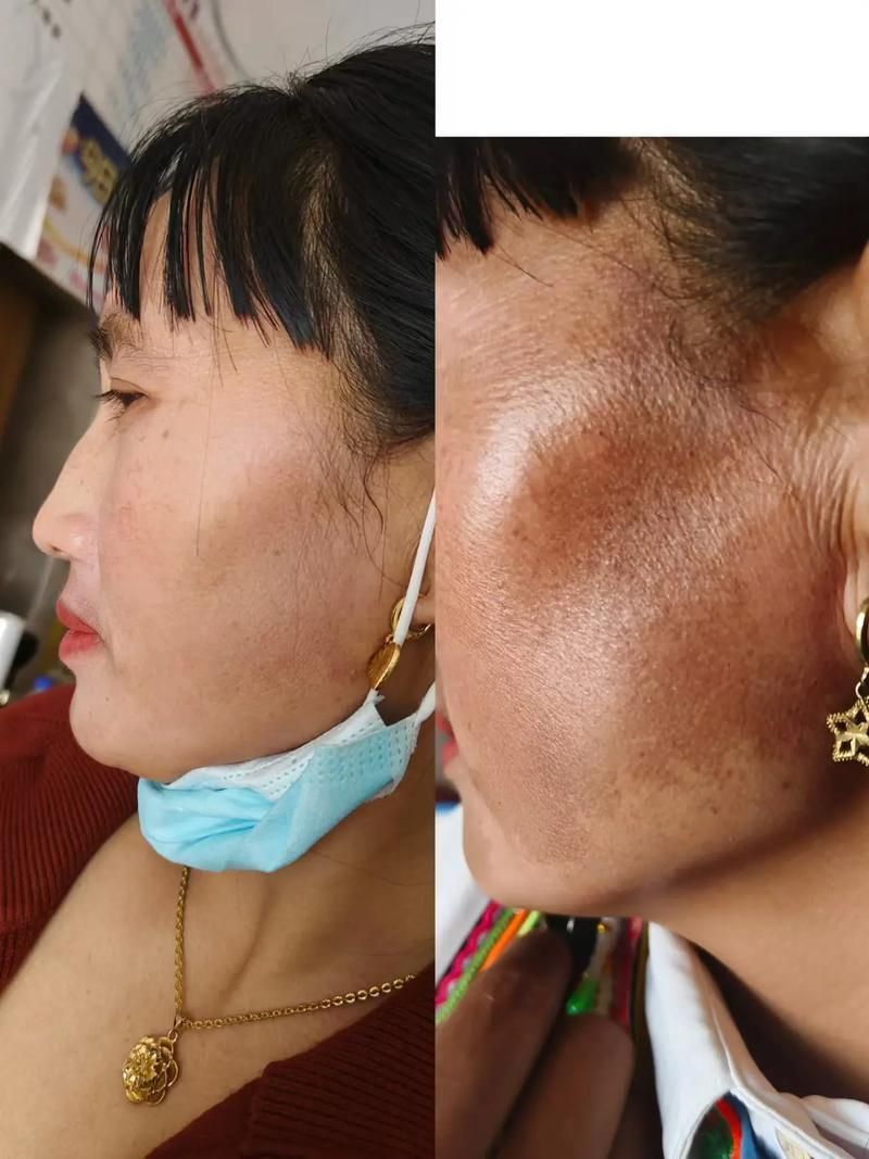 如何判斷魚鱗珠是否去除干凈,arxiv論文助手魚鱗珠是否去除干凈與否去除干凈 龍魚百科 第4張 如何判斷魚鱗珠是否去除干凈,arxiv論文助手魚鱗珠是否去除干凈與否去除干凈 如何判斷魚鱗珠是否去除干凈,arxiv論文助手魚鱗珠是否去除干凈與否去除干凈 龍魚百科 第4張