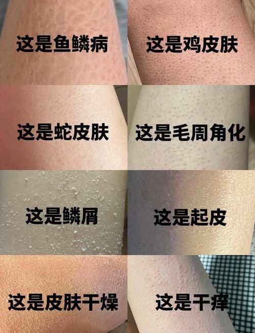 如何判斷魚鱗珠是否去除干凈,arxiv論文助手魚鱗珠是否去除干凈與否去除干凈 龍魚百科 第1張 如何判斷魚鱗珠是否去除干凈,arxiv論文助手魚鱗珠是否去除干凈與否去除干凈 如何判斷魚鱗珠是否去除干凈,arxiv論文助手魚鱗珠是否去除干凈與否去除干凈 龍魚百科 第1張