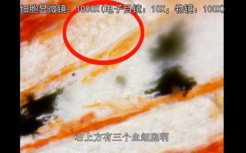 如何預防魚鰭根部發紅傳染,如何預防魚缸魚鰭根部發紅 龍魚百科 第2張 如何預防魚鰭根部發紅傳染,如何預防魚缸魚鰭根部發紅 如何預防魚鰭根部發紅傳染,如何預防魚缸魚鰭根部發紅 龍魚百科 第2張