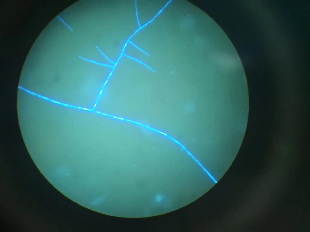 鰓霉病和蟲鰓哪個更嚴重，水產養殖中的鰓霉病與蟲鰓霉病的“花鰓”樣病變與菌絲結構