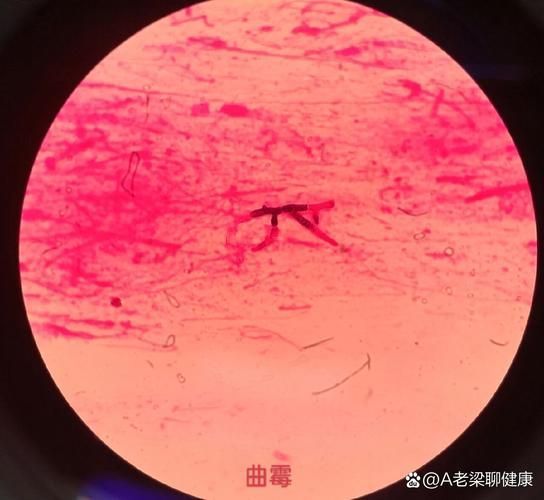 如何判斷龍魚蒙眼是否由真菌引起，%～20%20%20%20%20%20%氫氧化鉀
