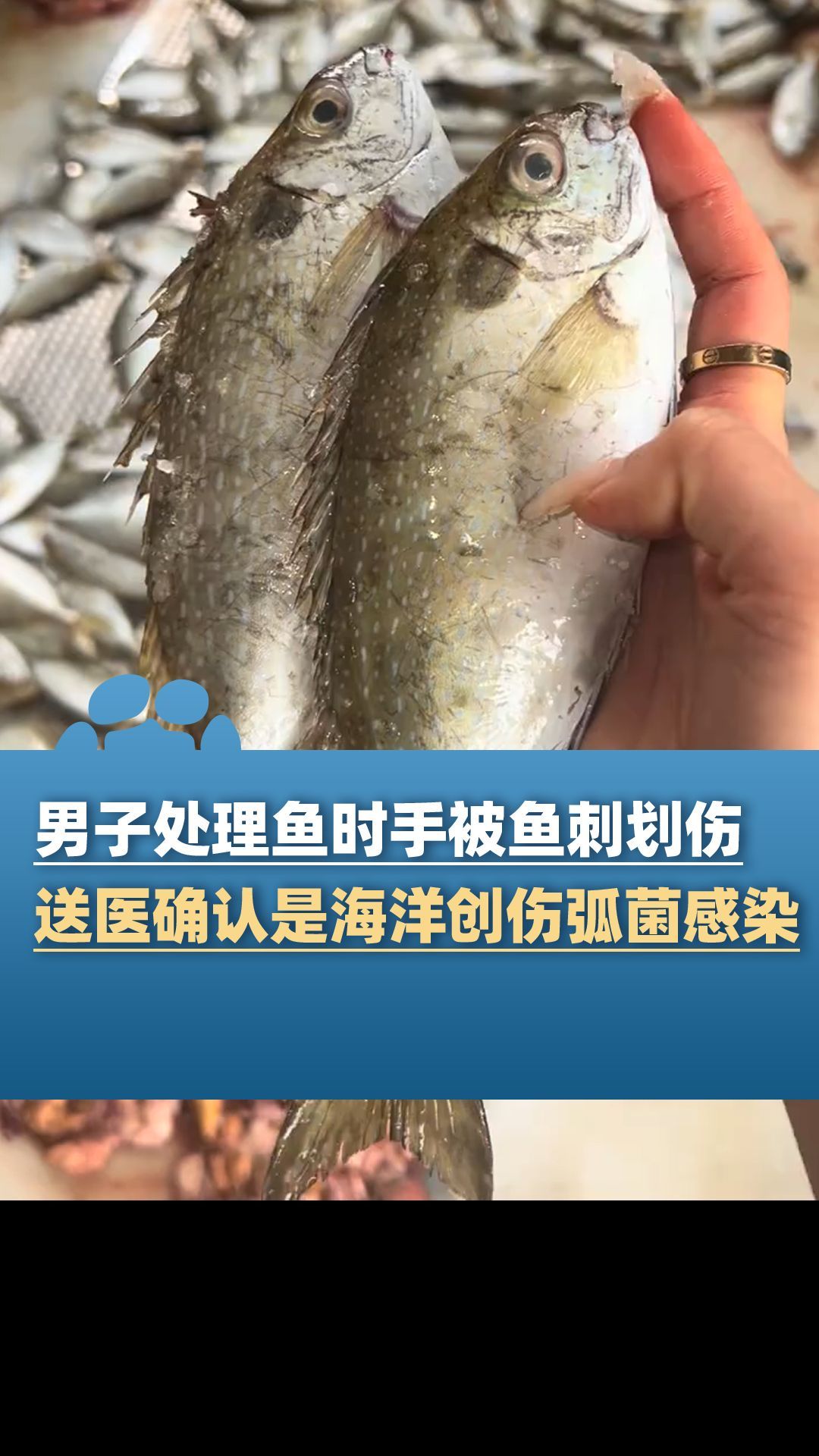 海洋創傷弧菌感染有哪些治療方法，創傷弧菌感染如何治療