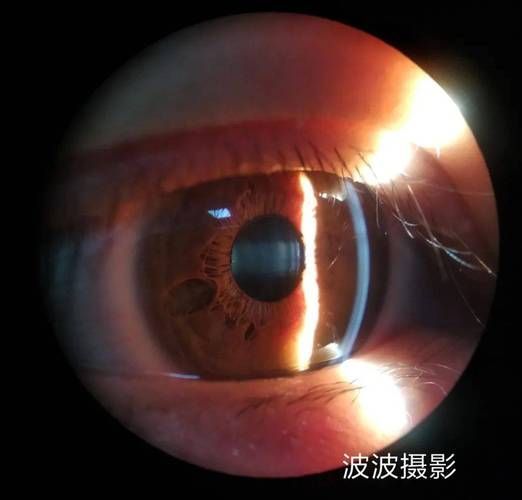 如何判斷魚眼白膜的類型，如何判斷魚眼白膜 如何判斷魚眼白膜的類型，如何判斷魚眼白膜 龍魚百科 第2張