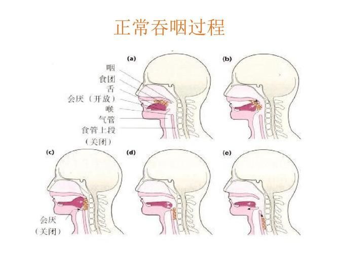 如何判斷患者是否需要喂食，共調(diào)用3個(gè)工具,用戶要求詳解如何判斷患者是否需要喂食