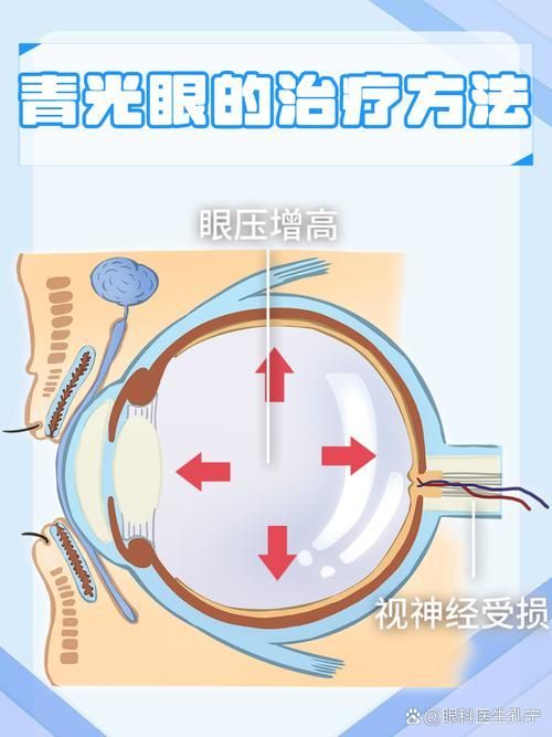 氣蒙眼如何快速緩解，“氣蒙眼”的診斷方法