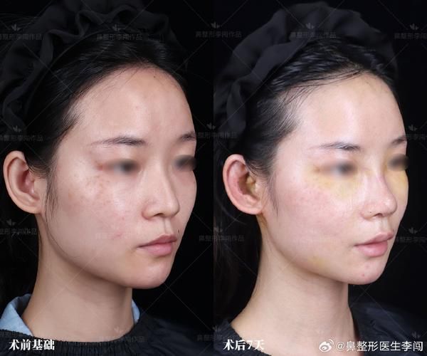 魚爛鰓病如何治療有效