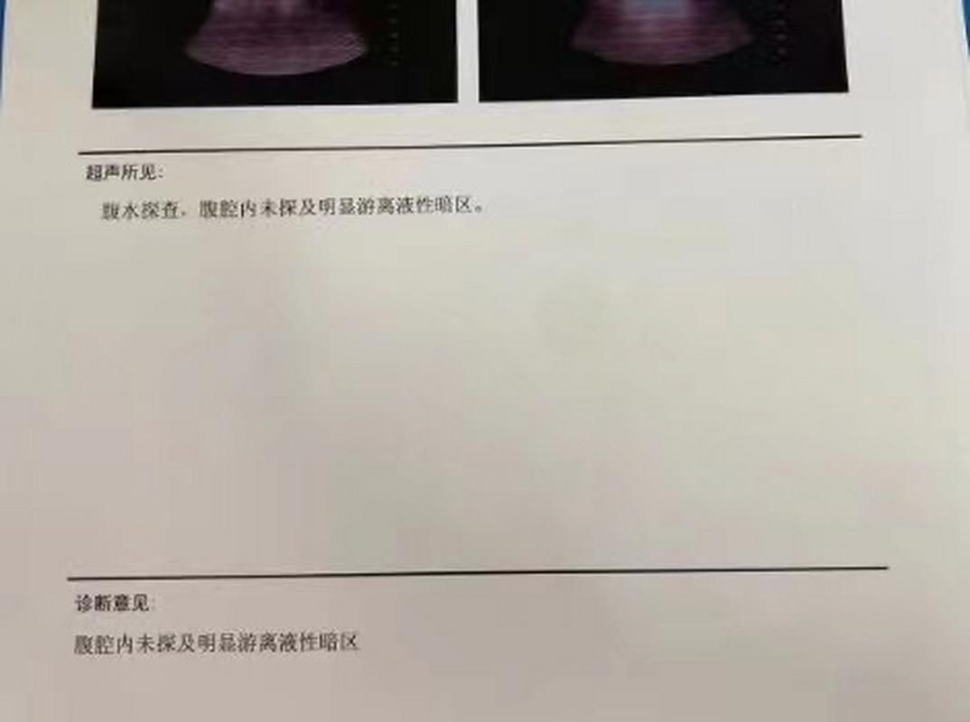 如何判斷魚腹水是否好轉(zhuǎn)，如何判斷腹水好轉(zhuǎn) 如何判斷魚腹水是否好轉(zhuǎn)，如何判斷腹水好轉(zhuǎn) 龍魚百科 第5張