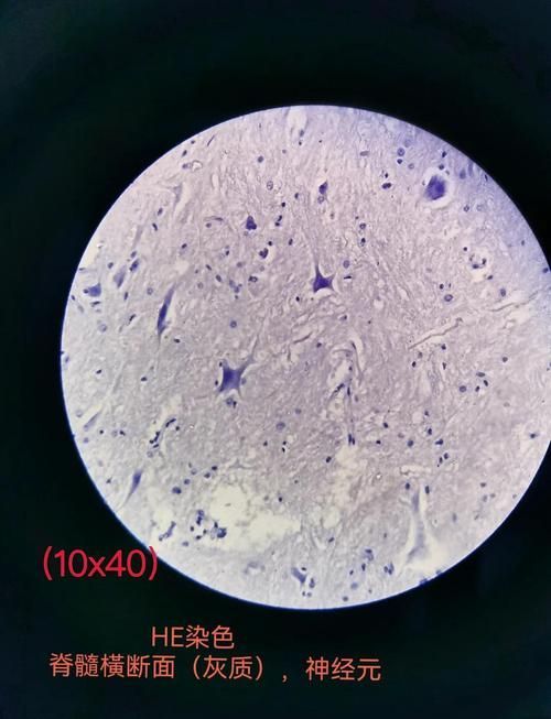 魚虱寄生蟲有哪些種類,關于魚虱寄生蟲的一些問題 龍魚百科 第3張 魚虱寄生蟲有哪些種類,關于魚虱寄生蟲的一些問題 魚虱寄生蟲有哪些種類,關于魚虱寄生蟲的一些問題 龍魚百科 第3張