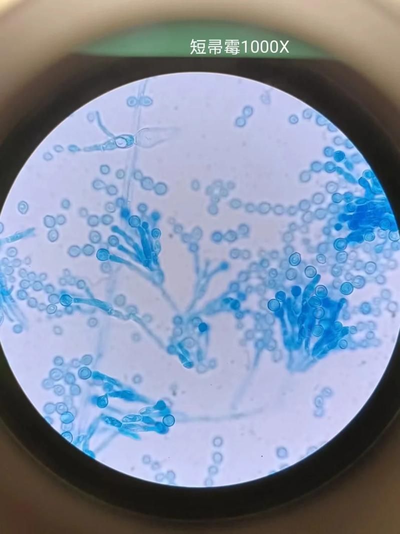 能否提供更多關于真菌和細菌的圖片，生物學研究中真菌和細菌的圖片生成的一段摘要：真菌和細菌