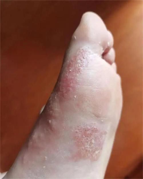 能否提供更多關于真菌和細菌的圖片，生物學研究中真菌和細菌的圖片生成的一段摘要：真菌和細菌