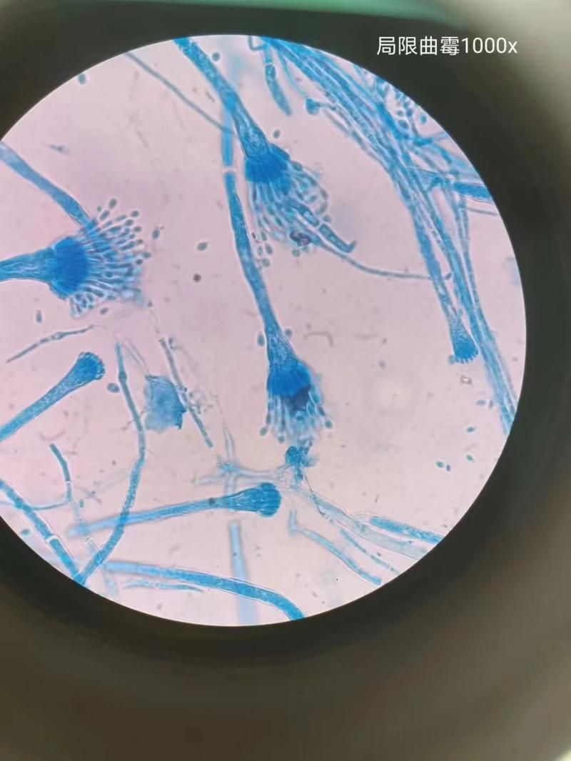 能否提供更多關(guān)于真菌和細(xì)菌的圖片，生物學(xué)研究中真菌和細(xì)菌的圖片生成的一段摘要：真菌和細(xì)菌