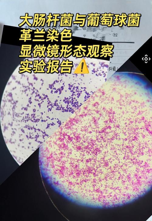點狀氣單胞菌有哪些主要形態特征,性狀氣單胞菌(aeromonaspunctata) 龍魚百科 第4張 點狀氣單胞菌有哪些主要形態特征,性狀氣單胞菌(aeromonaspunctata) 點狀氣單胞菌有哪些主要形態特征,性狀氣單胞菌(aeromonaspunctata) 龍魚百科 第4張