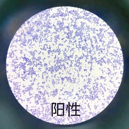 點狀氣單胞菌有哪些主要形態特征,性狀氣單胞菌(aeromonaspunctata) 龍魚百科 第1張 點狀氣單胞菌有哪些主要形態特征,性狀氣單胞菌(aeromonaspunctata) 點狀氣單胞菌有哪些主要形態特征,性狀氣單胞菌(aeromonaspunctata) 龍魚百科 第1張