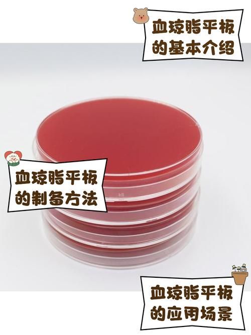 點狀氣單胞菌有哪些主要形態特征,性狀氣單胞菌(aeromonaspunctata) 龍魚百科 第7張 點狀氣單胞菌有哪些主要形態特征,性狀氣單胞菌(aeromonaspunctata) 點狀氣單胞菌有哪些主要形態特征,性狀氣單胞菌(aeromonaspunctata) 龍魚百科 第7張
