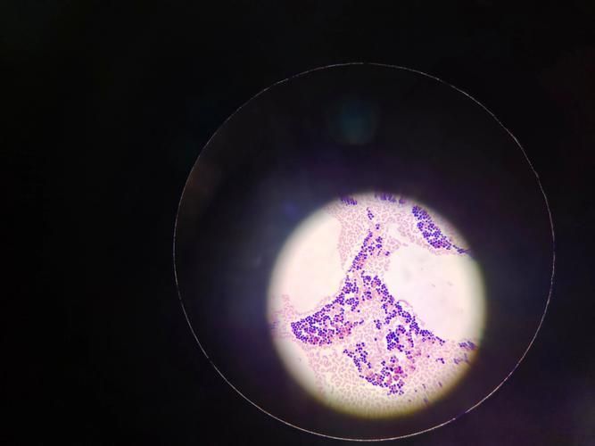 點狀氣單胞菌有哪些主要形態特征,性狀氣單胞菌(aeromonaspunctata) 龍魚百科 第6張 點狀氣單胞菌有哪些主要形態特征,性狀氣單胞菌(aeromonaspunctata) 點狀氣單胞菌有哪些主要形態特征,性狀氣單胞菌(aeromonaspunctata) 龍魚百科 第6張