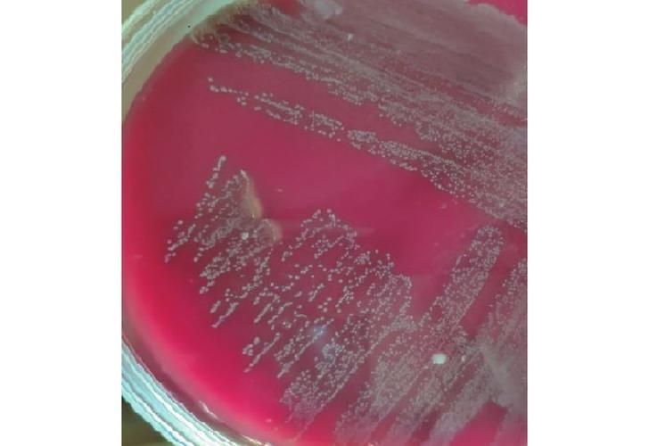 點狀氣單胞菌有哪些主要形態特征,性狀氣單胞菌(aeromonaspunctata) 龍魚百科 第8張 點狀氣單胞菌有哪些主要形態特征,性狀氣單胞菌(aeromonaspunctata) 點狀氣單胞菌有哪些主要形態特征,性狀氣單胞菌(aeromonaspunctata) 龍魚百科 第8張