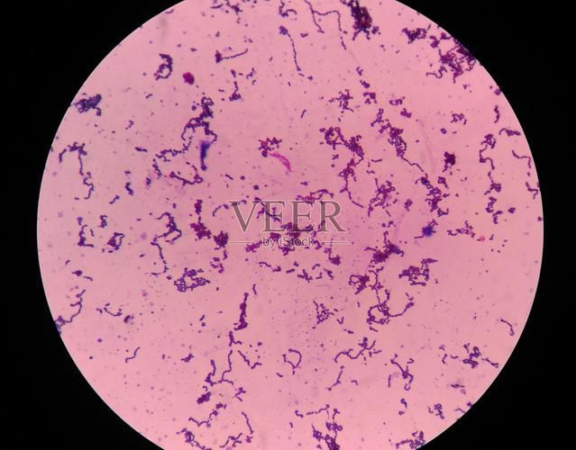 點狀氣單胞菌有哪些主要形態特征,性狀氣單胞菌(aeromonaspunctata) 龍魚百科 第5張 點狀氣單胞菌有哪些主要形態特征,性狀氣單胞菌(aeromonaspunctata) 點狀氣單胞菌有哪些主要形態特征,性狀氣單胞菌(aeromonaspunctata) 龍魚百科 第5張