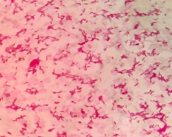 點狀氣單胞菌有哪些主要形態特征,性狀氣單胞菌(aeromonaspunctata) 龍魚百科 第2張 點狀氣單胞菌有哪些主要形態特征,性狀氣單胞菌(aeromonaspunctata) 點狀氣單胞菌有哪些主要形態特征,性狀氣單胞菌(aeromonaspunctata) 龍魚百科 第2張