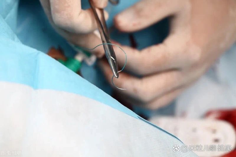 能否提供清創手術的詳細步驟，急診外科必備技能——清創縫合術 能否提供清創手術的詳細步驟，急診外科必備技能——清創縫合術 龍魚百科 第1張