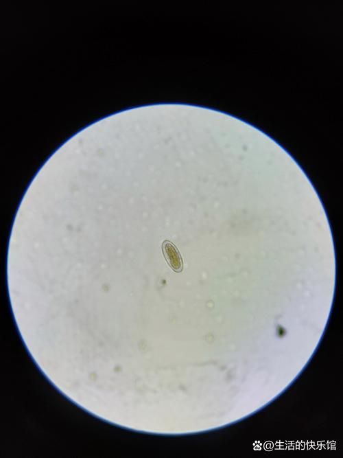 魚虱的卵是如何孵化的，arxiv論文助手魚虱的卵孵化過程是如何孵化