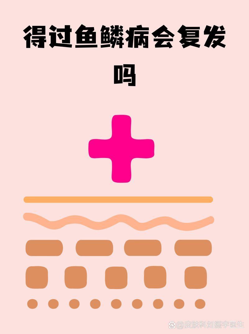 有哪些方法可以預防炸鱗病復發