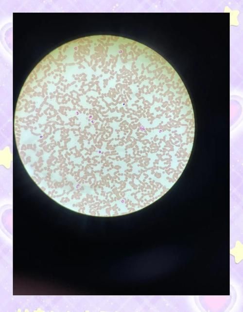 手機(jī)顯微鏡如何輔助診斷，華為手機(jī)顯微鏡需補(bǔ)充1000字篇幅和配圖傳統(tǒng)顯微鏡