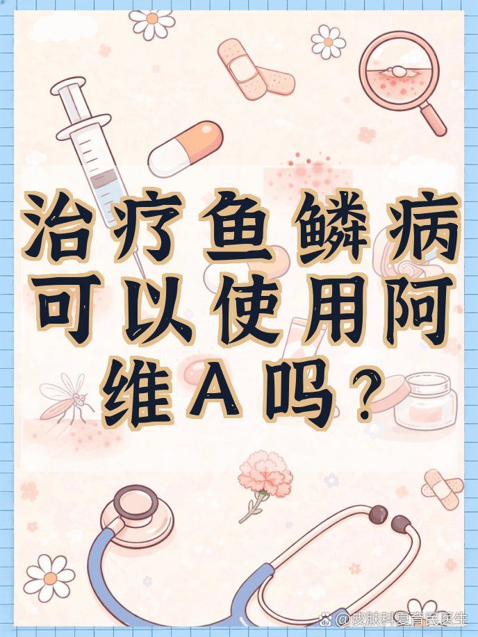 哪種藥物對魚鱗病最有效，治療魚鱗病的藥物