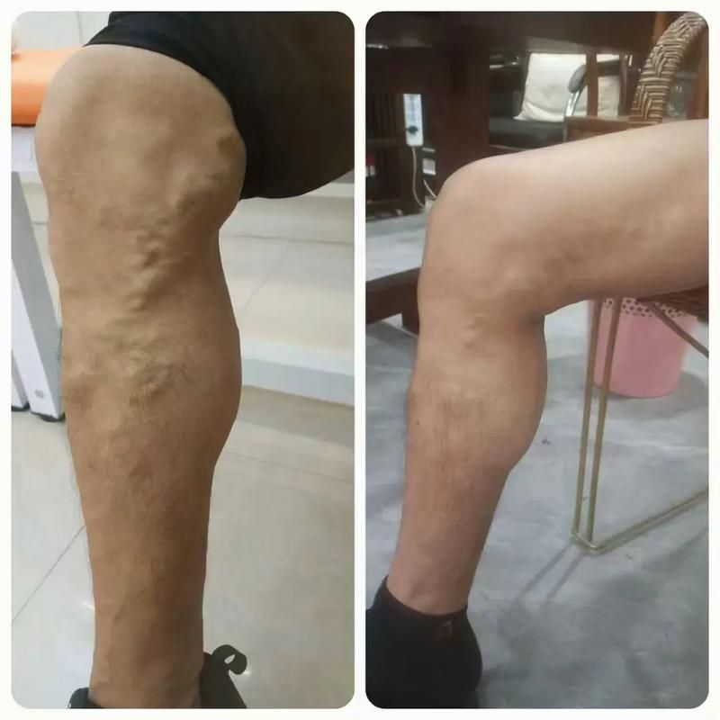 有沒有更多關于病理性膨脹的設定，“病理性膨脹”是什么意思？ 有沒有更多關于病理性膨脹的設定，“病理性膨脹”是什么意思？ 龍魚百科 第13張