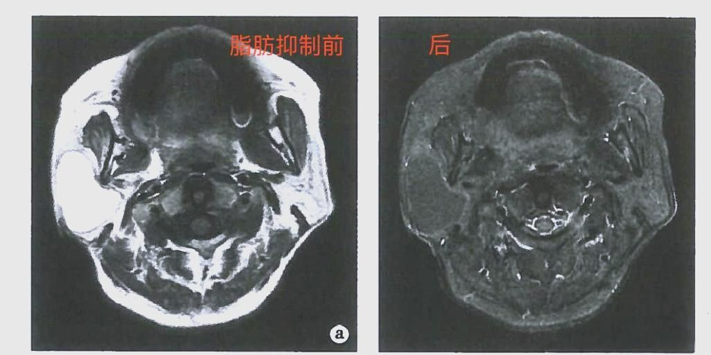 有沒有更多關于病理性膨脹的設定，“病理性膨脹”是什么意思？ 有沒有更多關于病理性膨脹的設定，“病理性膨脹”是什么意思？ 龍魚百科 第3張