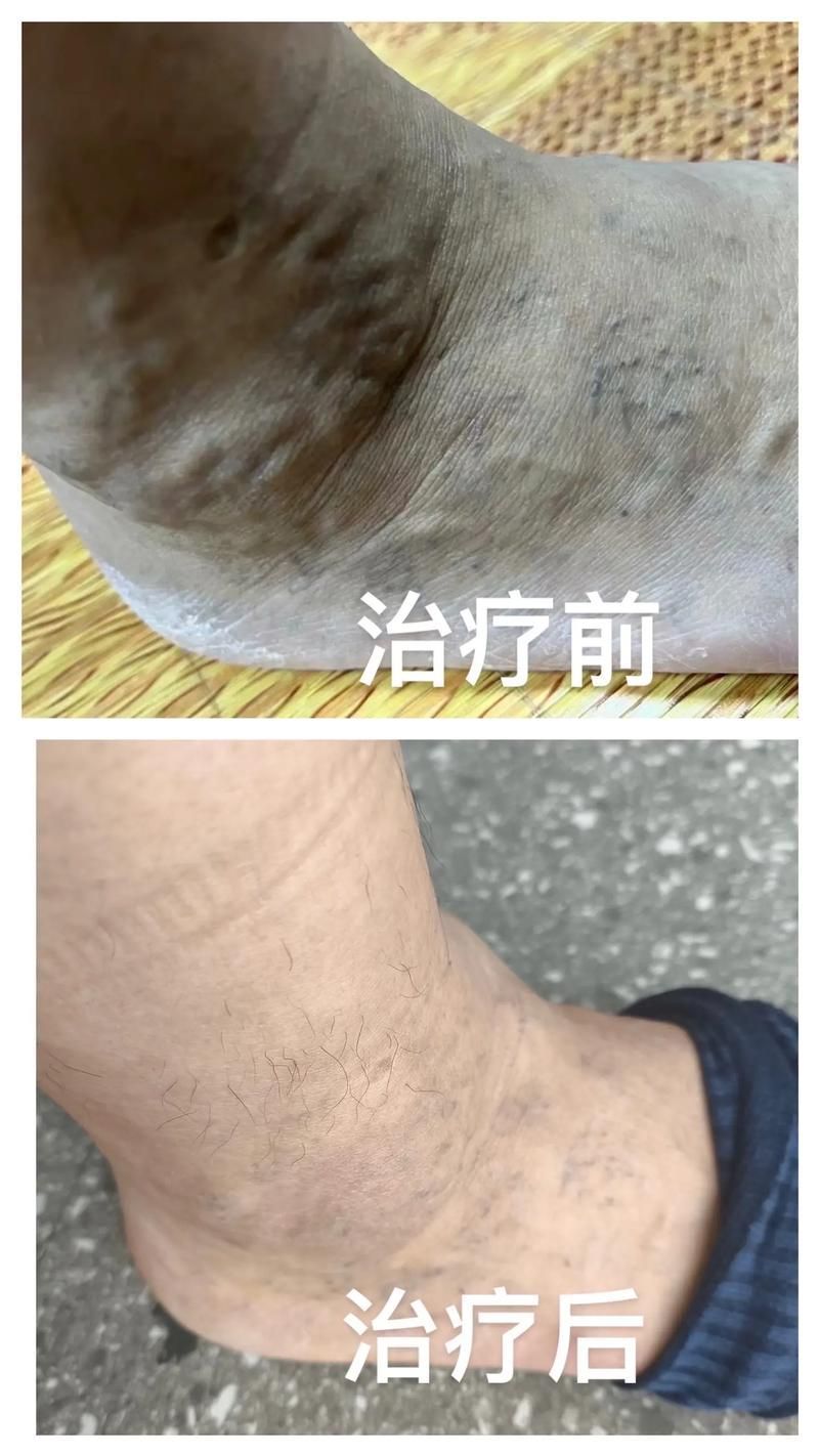有沒有更多關于病理性膨脹的設定，“病理性膨脹”是什么意思？ 有沒有更多關于病理性膨脹的設定，“病理性膨脹”是什么意思？ 龍魚百科 第14張